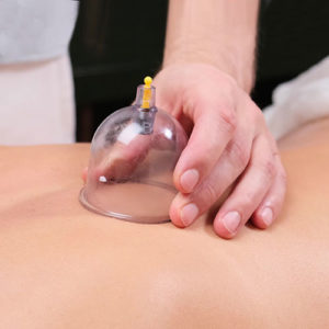 Myofascial cupping promotes healing by creating a suction and negative pressure with cups on the skin pulling tissues, blood and fluids to the skin's surface